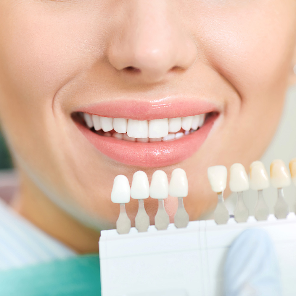 A woman with a bright smile, wearing dental braces and holding a tray of teeth aligners.